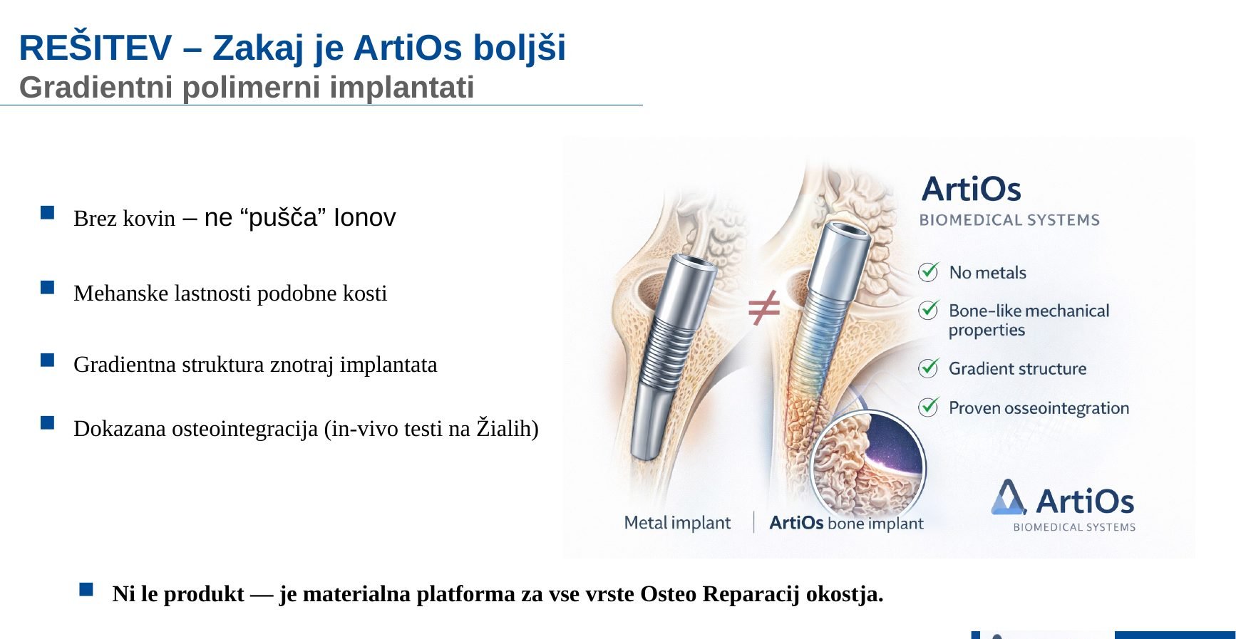 Gradientni polimerni implantati ArtiOs