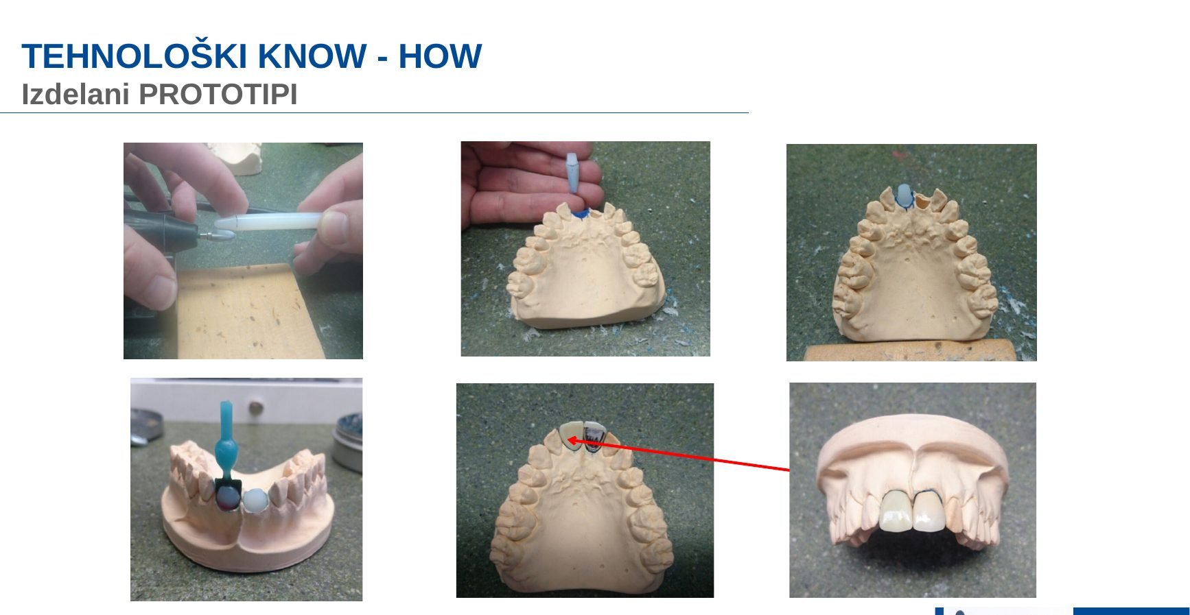 Prototipi v dentalnem modelu